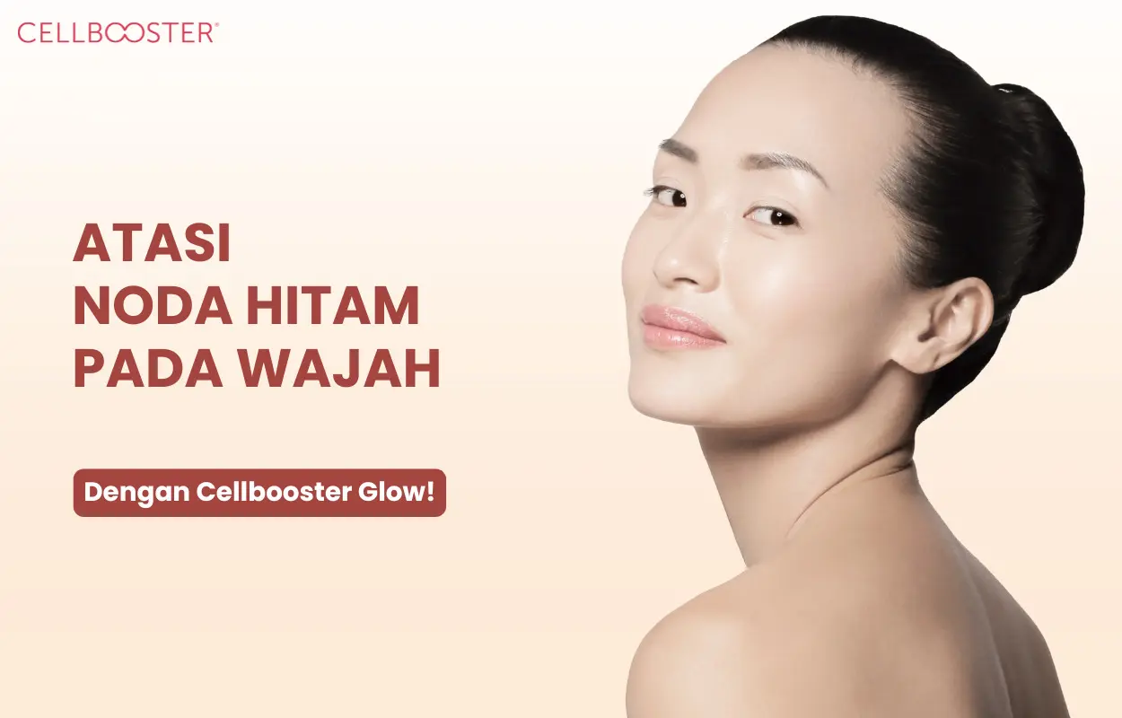 noda hitam pada wajah