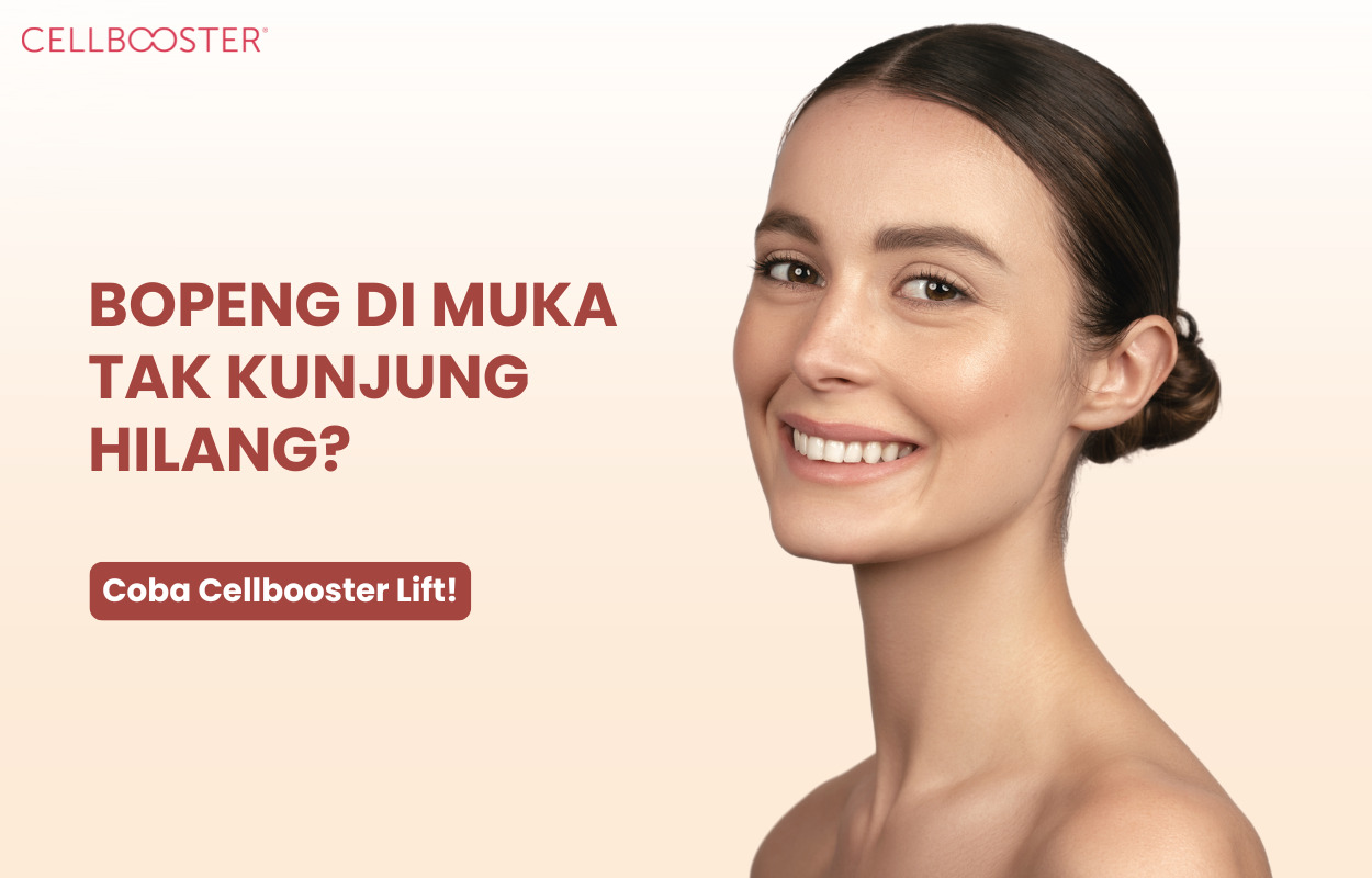 mengatasi bopeng di muka