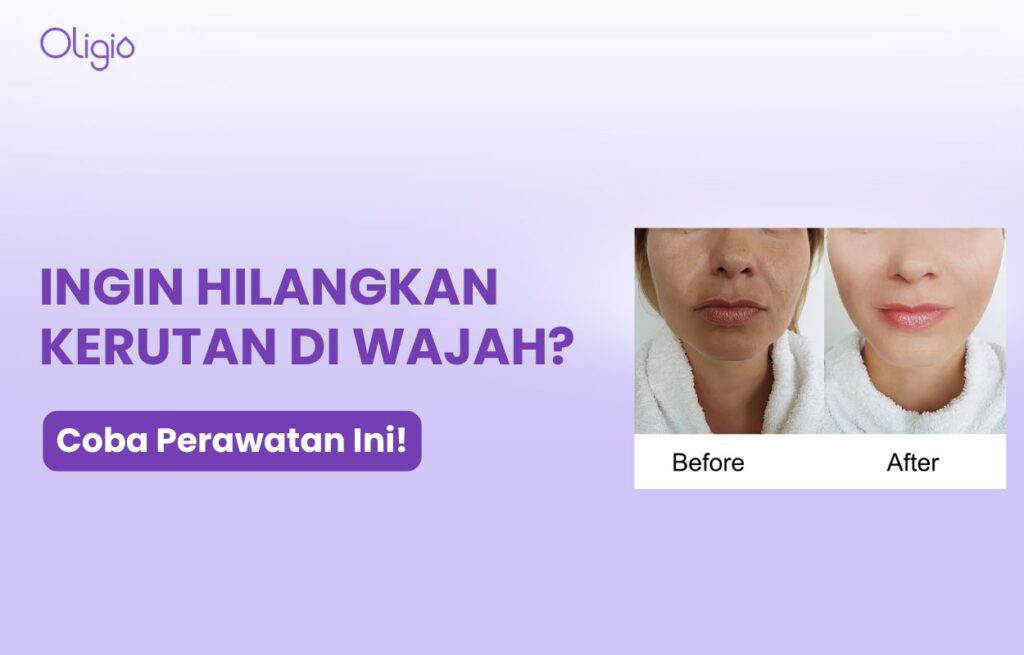 masker alami untuk menghilangkan kerutan di wajah