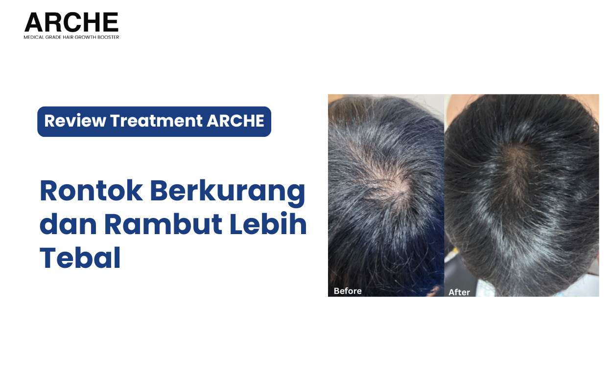 Hasil Setelah Lima Kali Perawatan: Rambut Rontok Berkurang