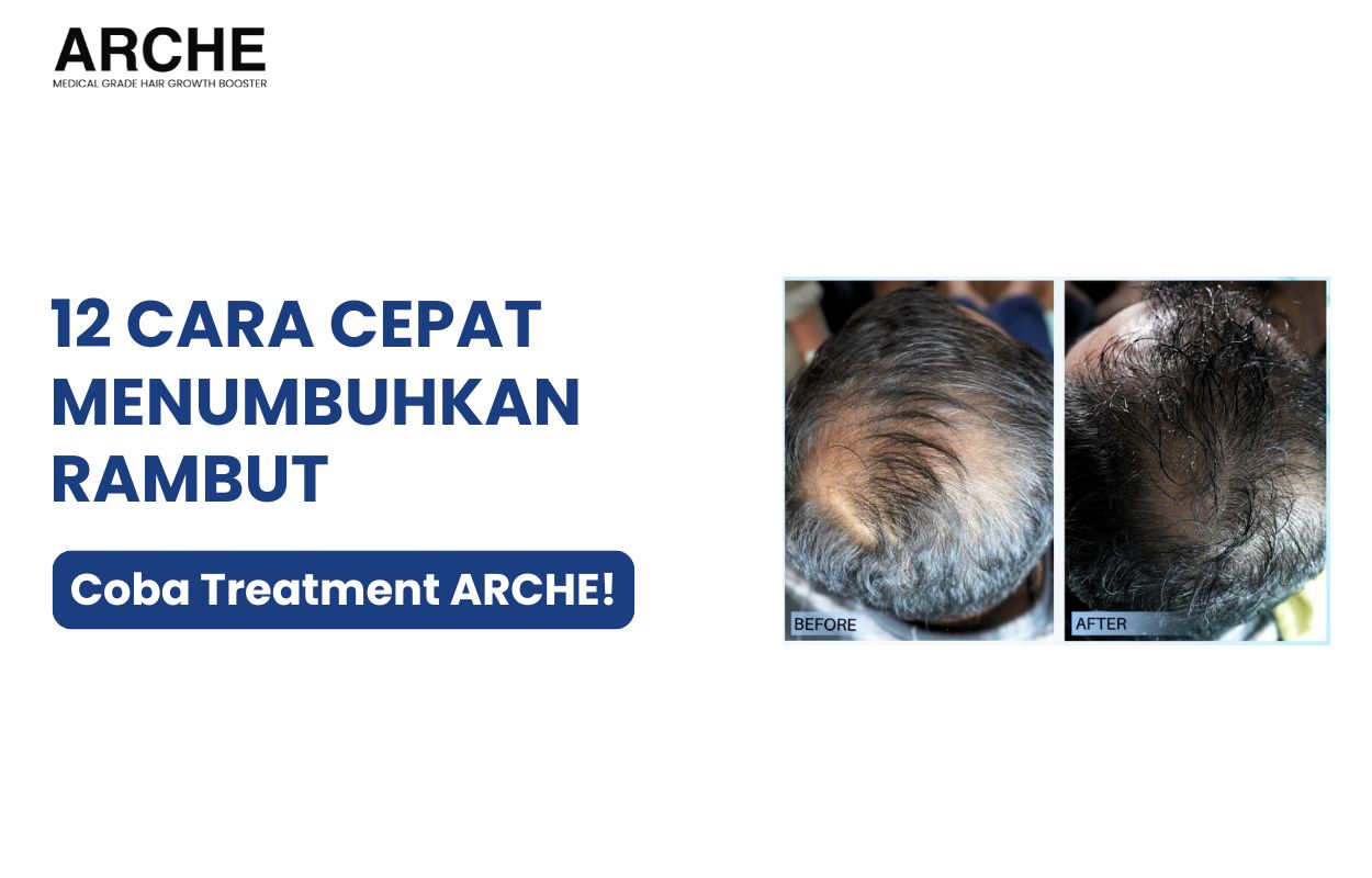 menumbuhkan rambut dengan cepat