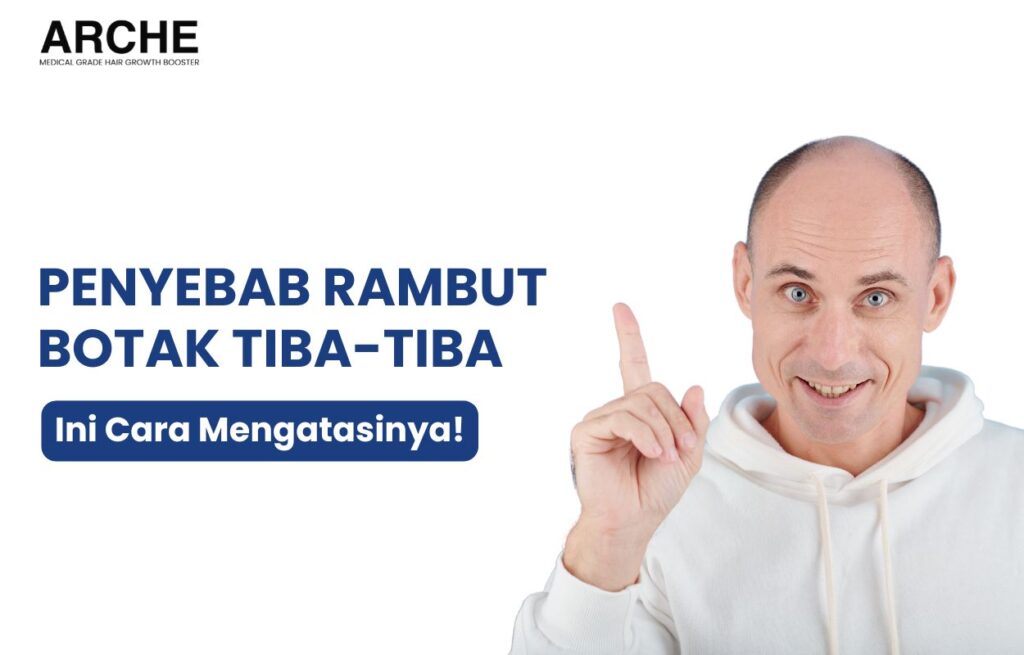 penyebab rambut botak tiba tiba