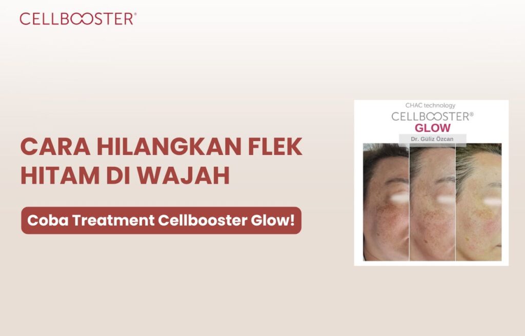 Menghilangkan Flek Hitam di Wajah Secara Alami dan Cepat