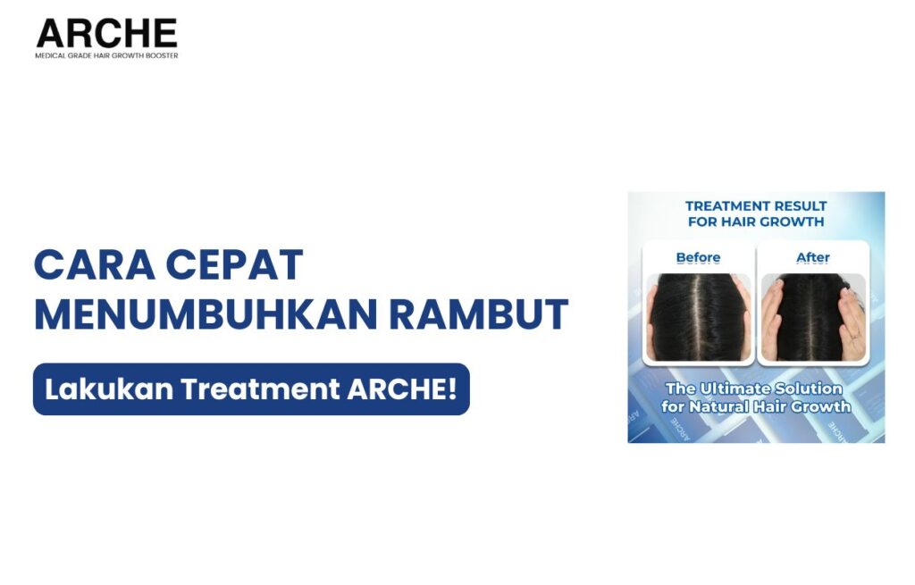 cara numbuhin rambut cepat