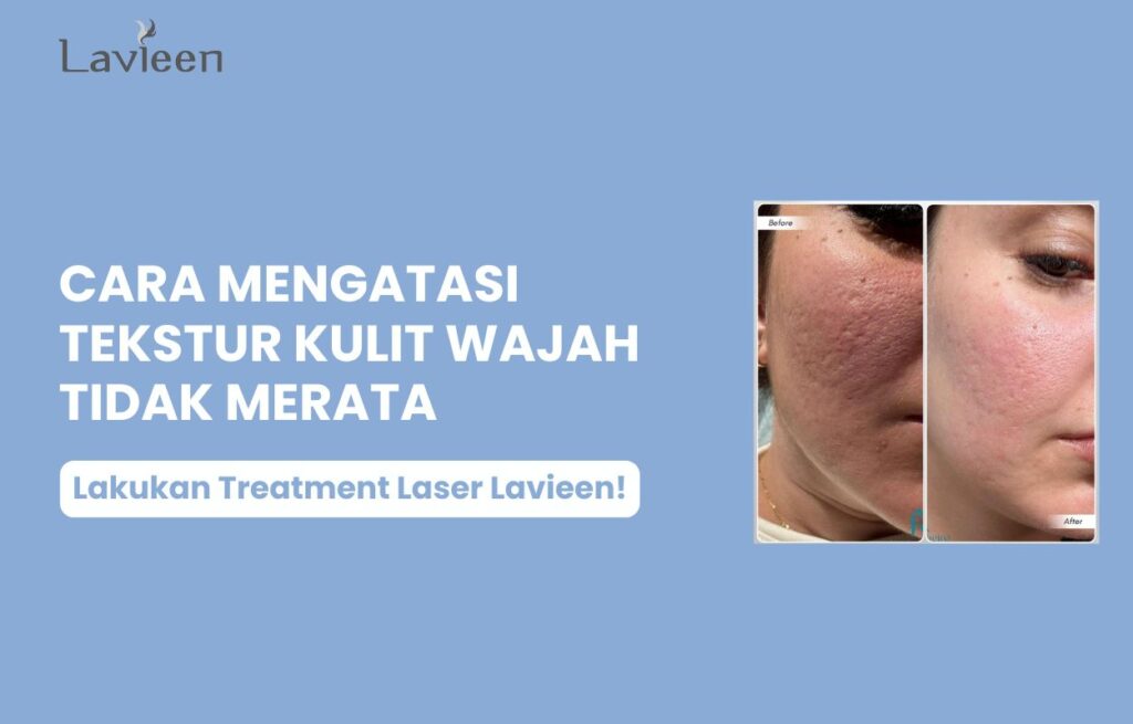 tekstur kulit wajah tidak merata