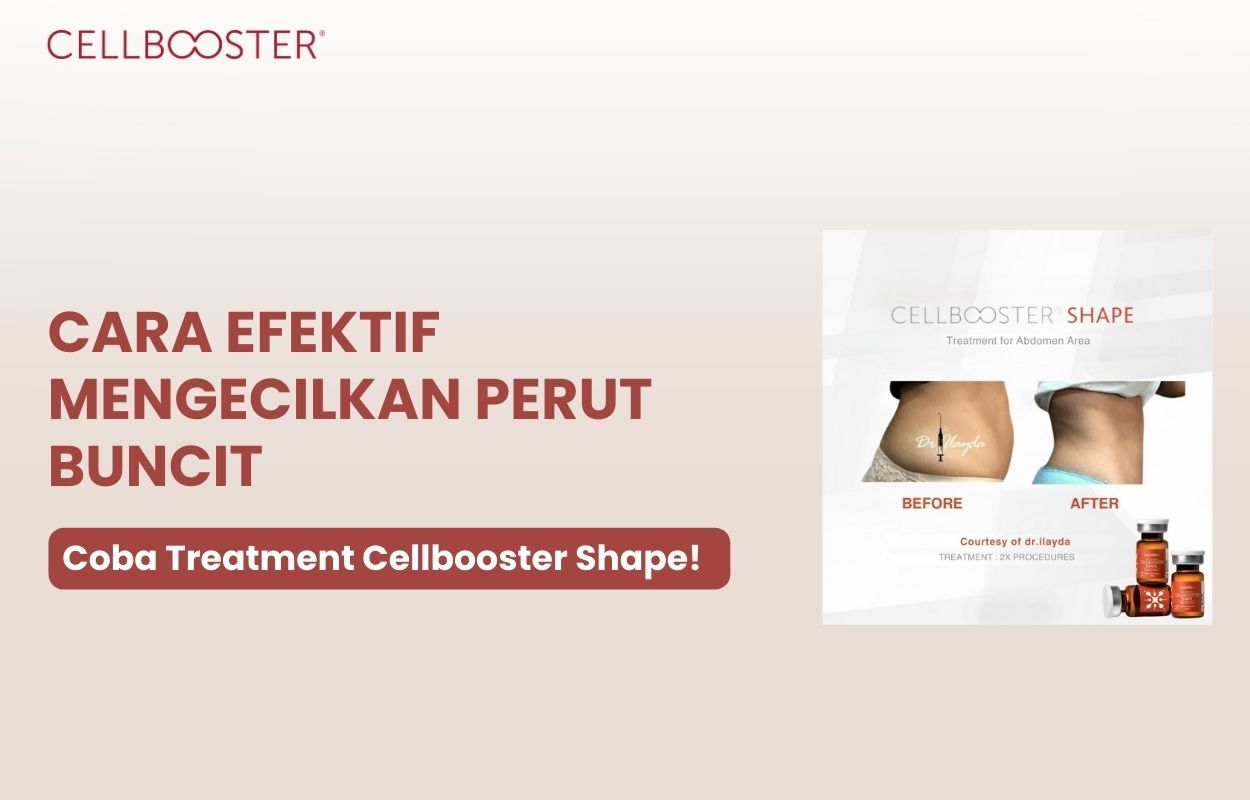 mengecilkan perut buncit