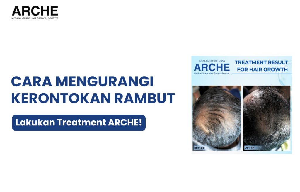 cara mengurangi kerontokan rambut