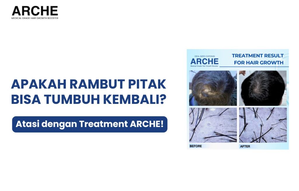 apakah rambut pitak bisa tumbuh kembali