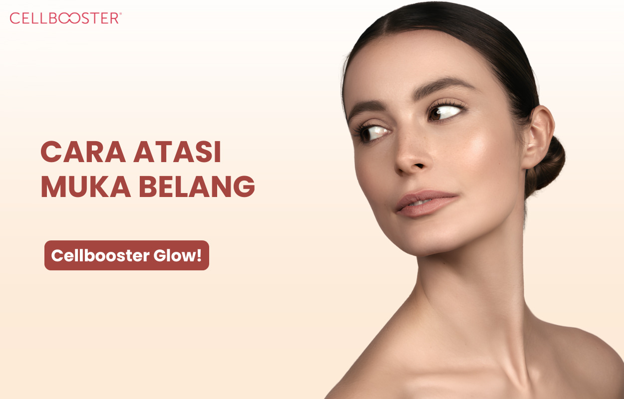 Cara Mengatasi Muka Belang