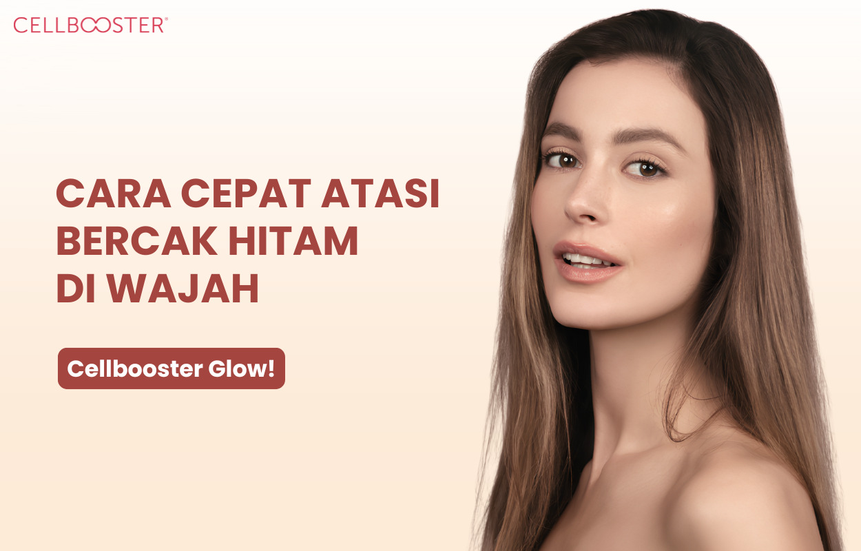 bercak hitam pada kulit