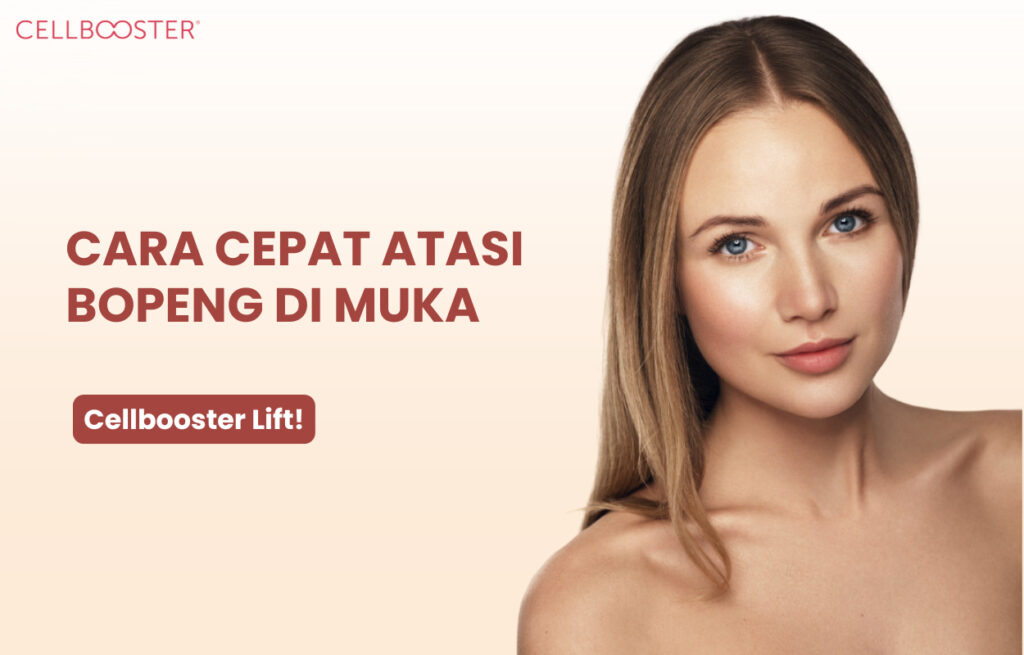 Cara Menghilangkan Bopeng di Muka
