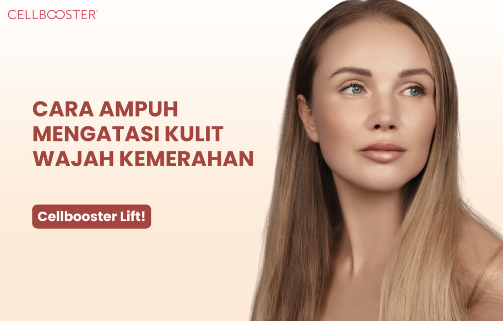 wajah kemerahan