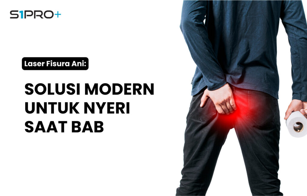 laser fisura ani