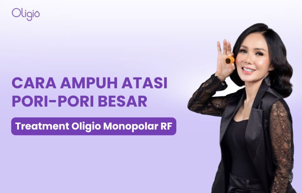 wajah pori pori besar