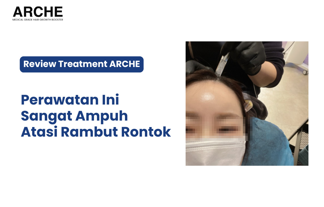 Perawatan ARCHE untuk Mengatasi Rambut Rontok