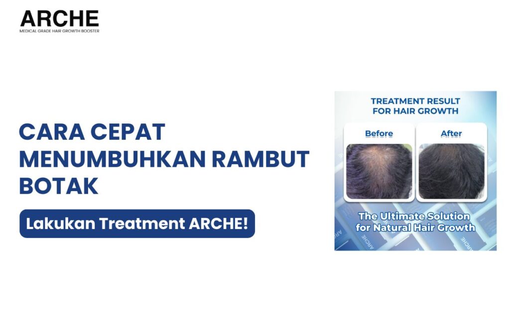 cara cepat menumbuhkan rambut botak dalam 1 minggu​