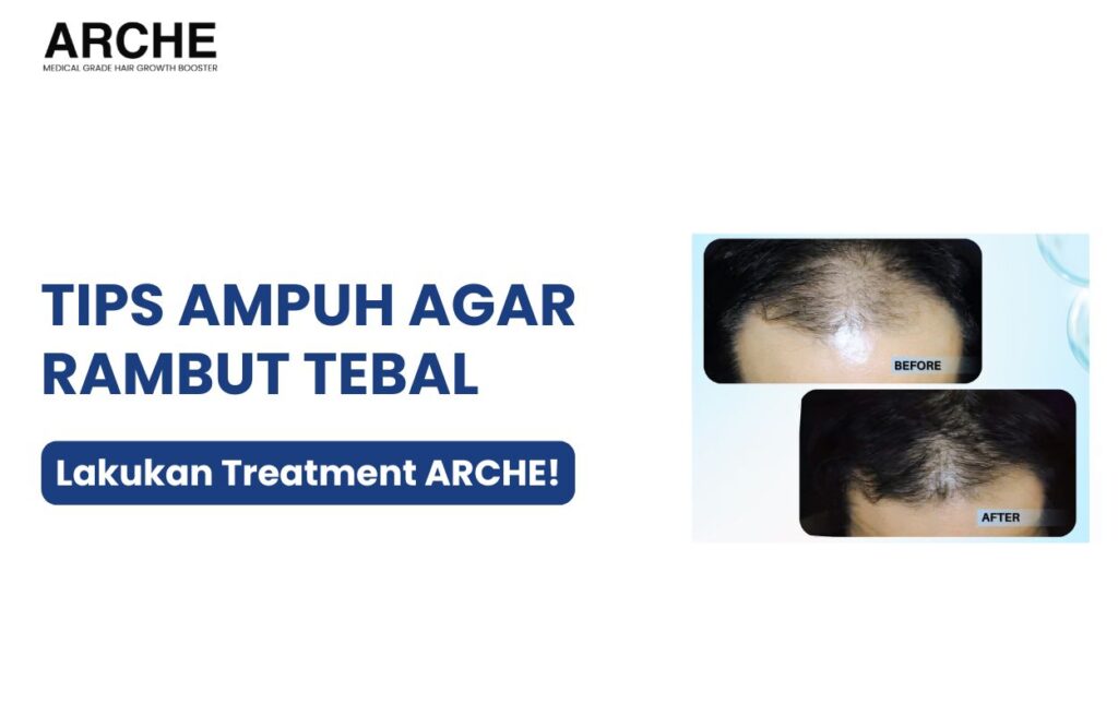 tips menebalkan rambut