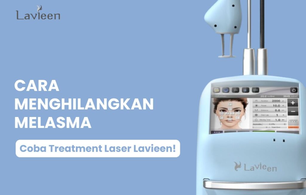 melasma wajah