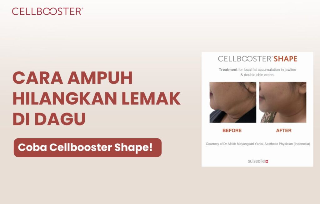 cara hilangkan lemak di dagu