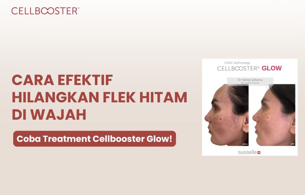cara menghilangkan flek hitam di wajah secara alami
