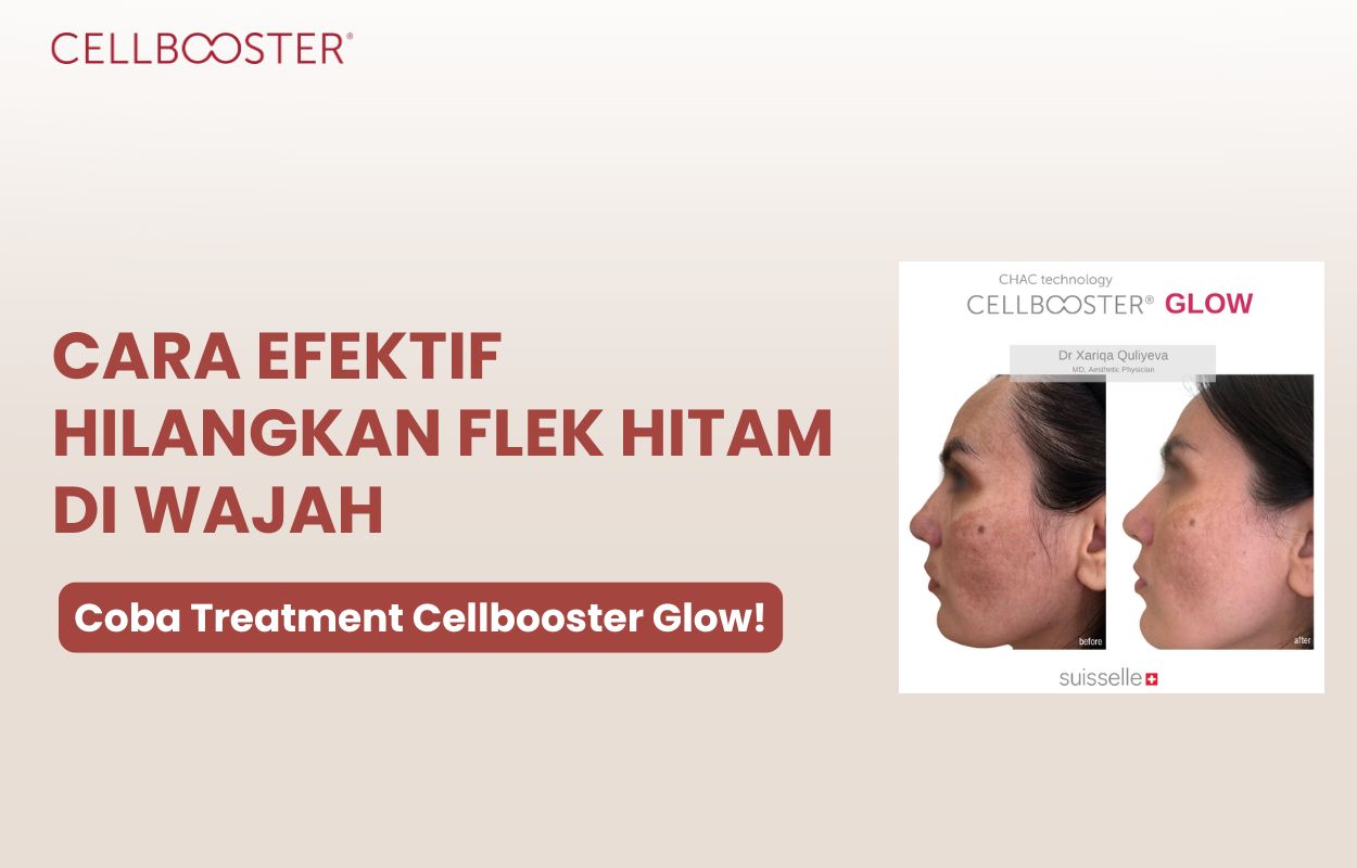 cara menghilangkan flek hitam di wajah secara alami