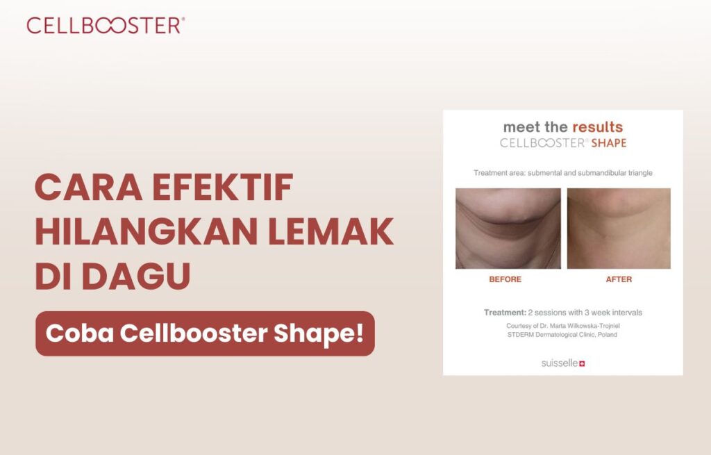 menghilangkan lemak di dagu