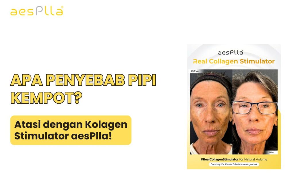 apa penyebab pipi kempot