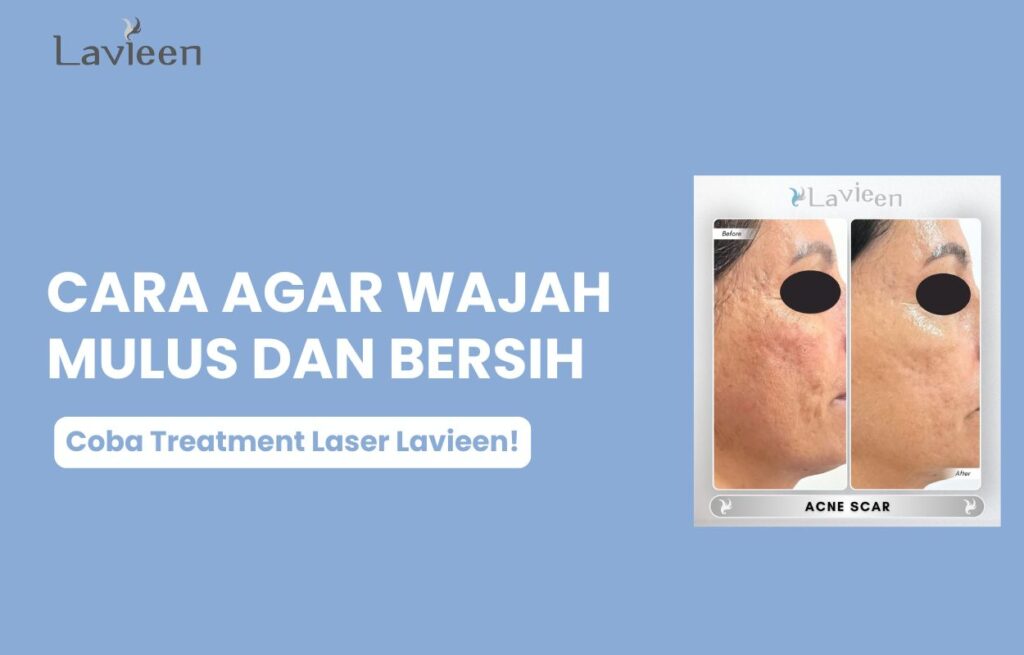 agar muka mulus