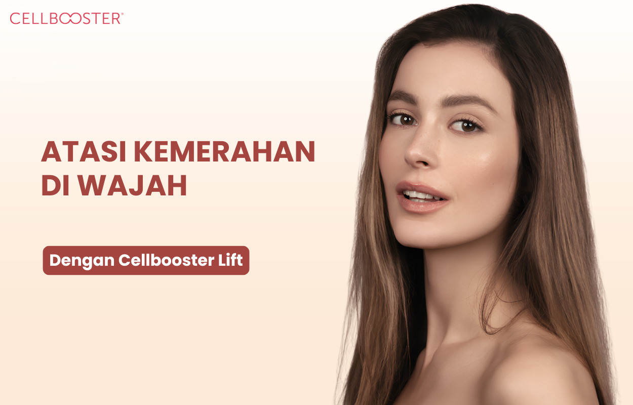 Penyebab dan Cara Mengatasi Kondisi Kulit Wajah yang Merah