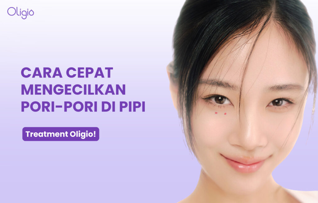 Cara Alami Mengecilkan Pori-pori di pipi