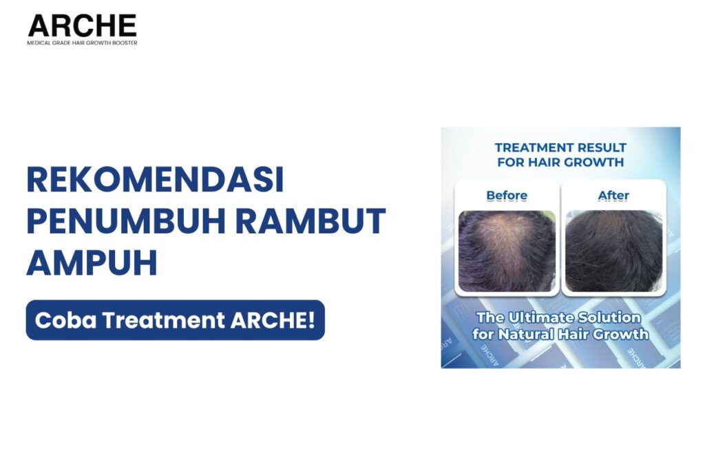 obat penumbuh rambut cepat dalam 1 minggu