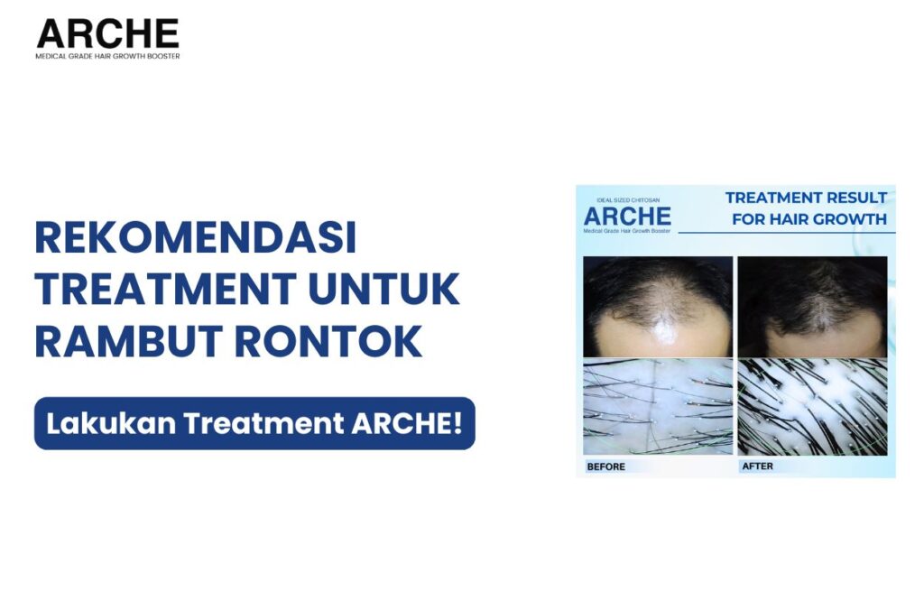 treatment untuk rambut rontok