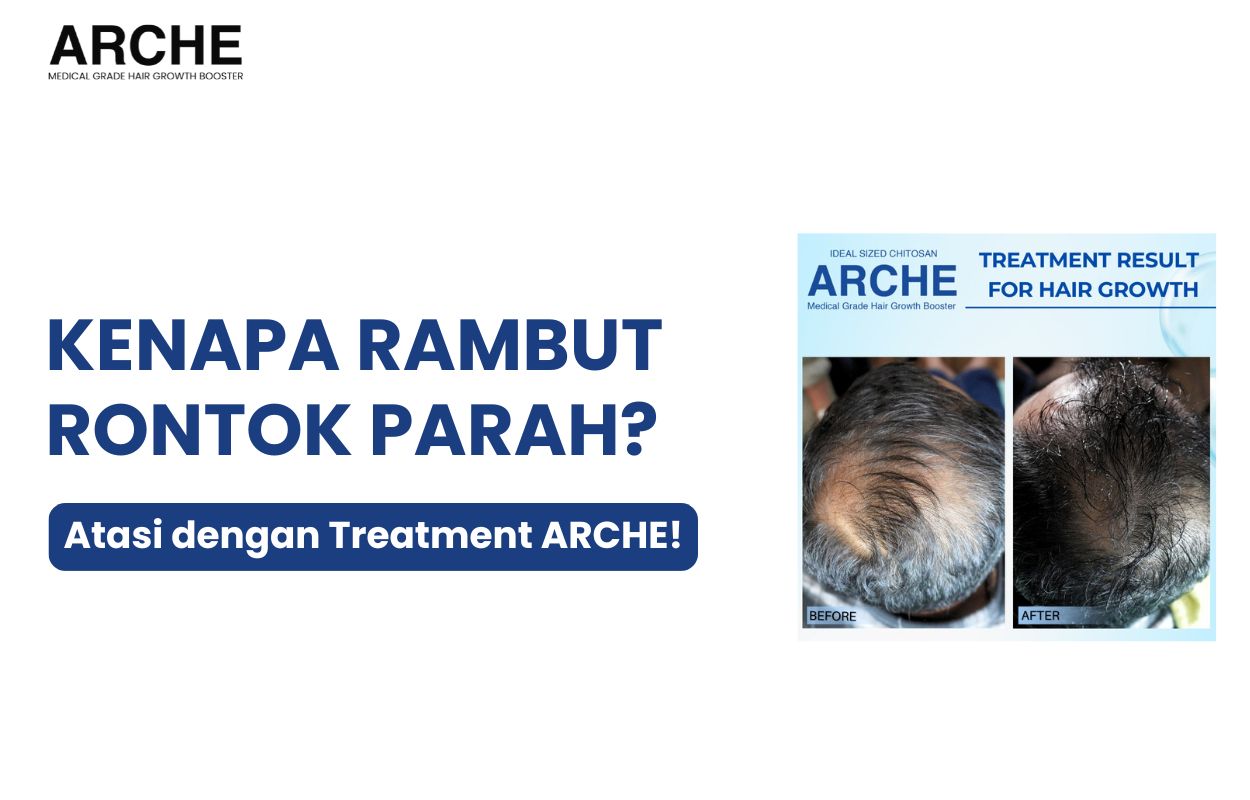 kenapa rambut rontok parah