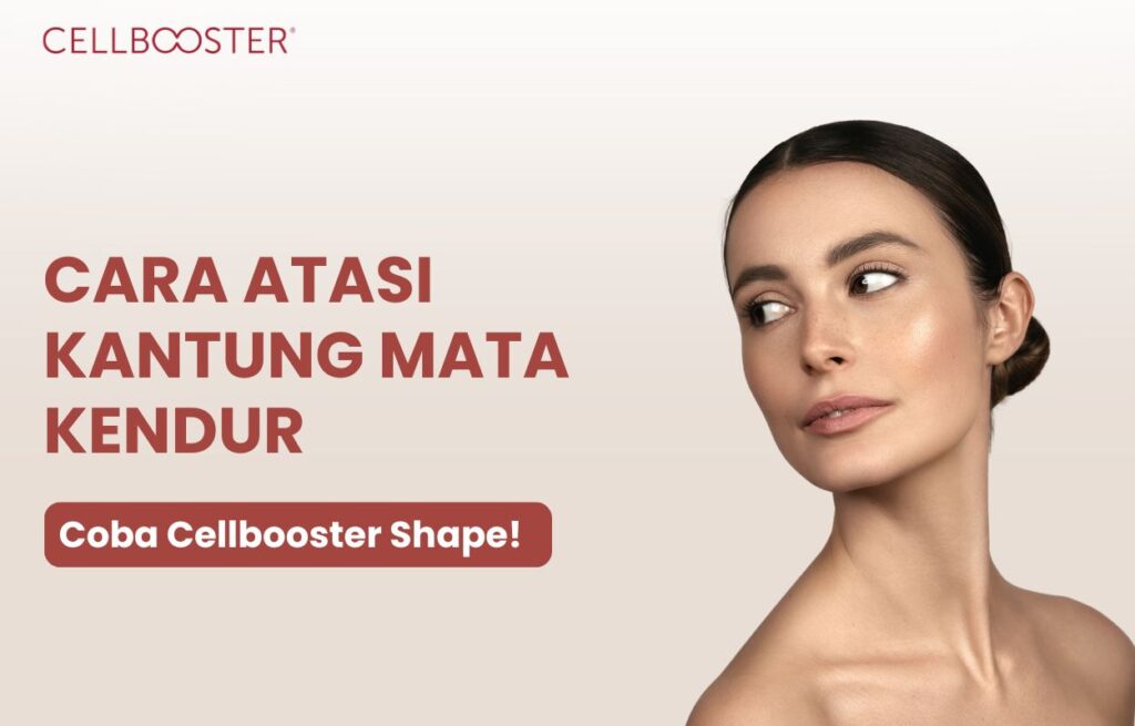 mengatasi kantung mata kendur