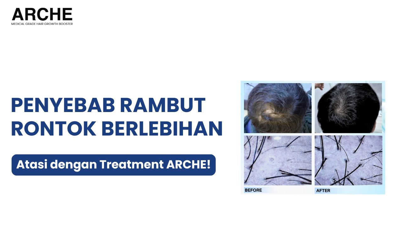 apa penyebab rambut rontok berlebihan