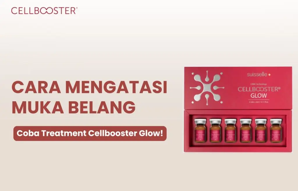 cara menghilangkan muka belang