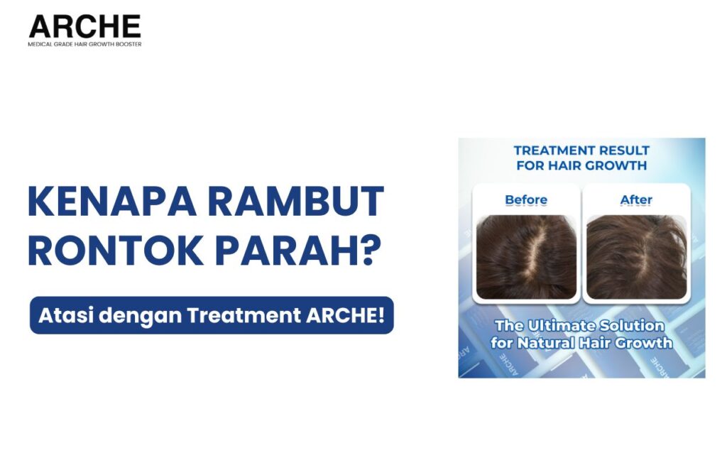 kenapa rambut rontok