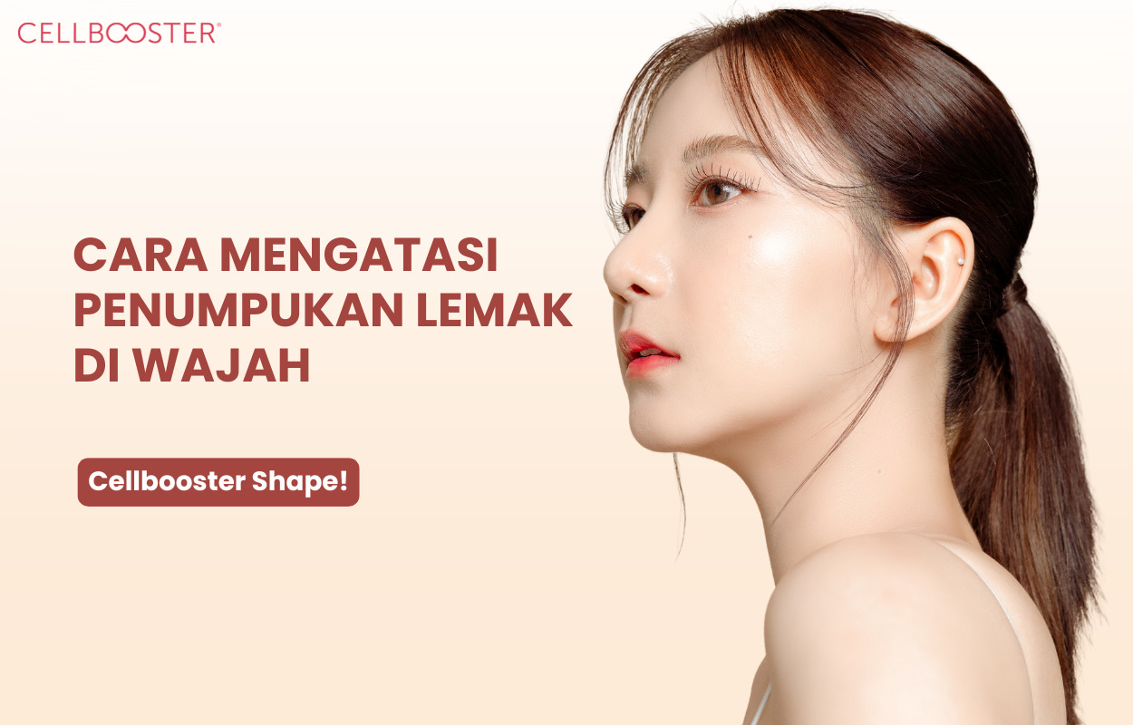 Penumpukan Lemak di Wajah