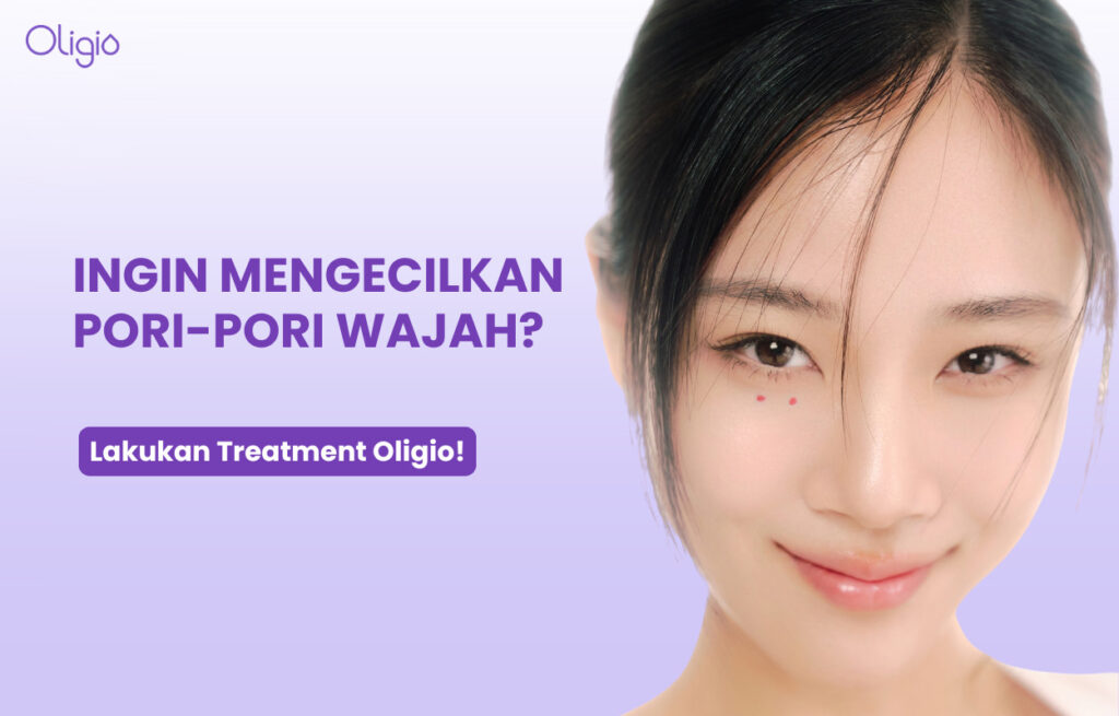 Kenapa Pori-pori Wajah Besar