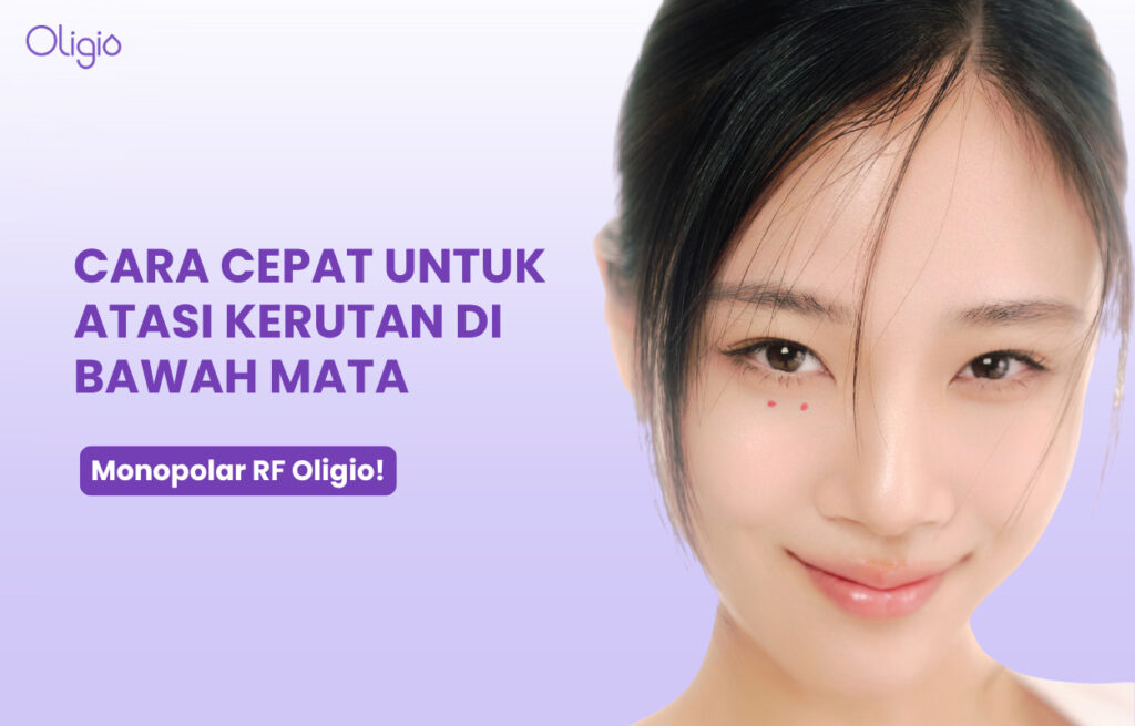 Kerutan di Mata