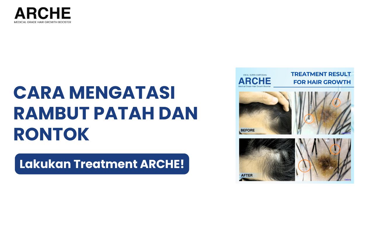 cara mengatasi rambut patah