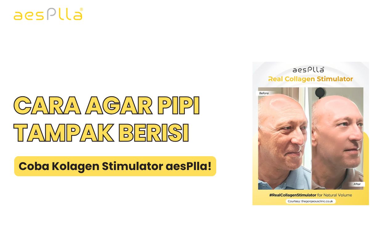 cara menggemukkan pipi