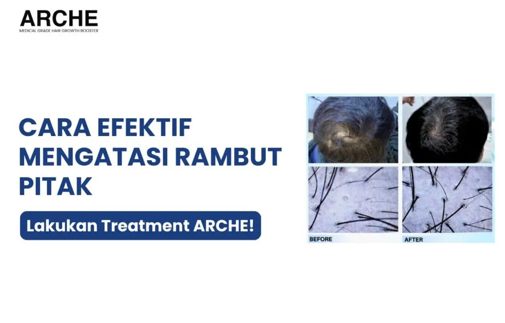 Pitak rambut