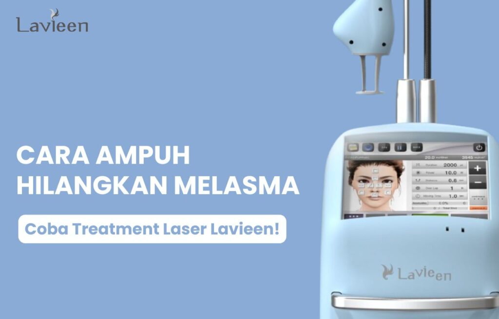 apakah melasma bisa hilang