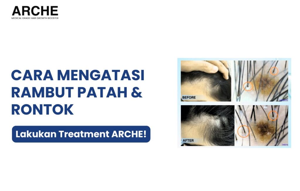 rambut patah