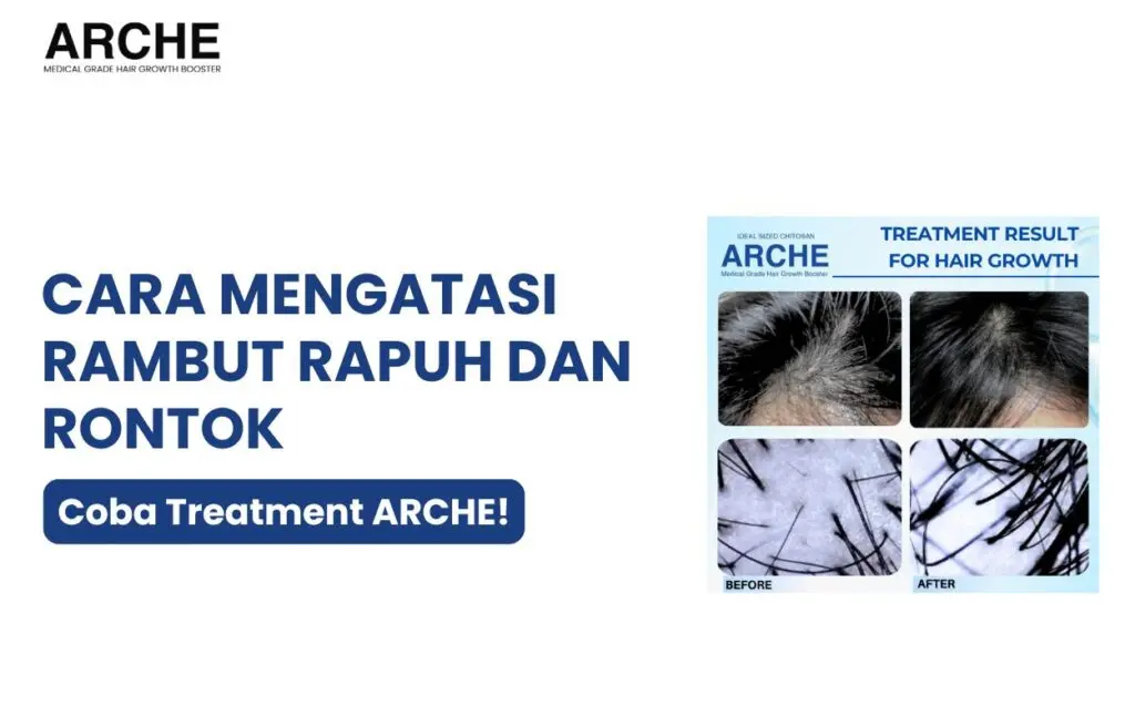 rambut rapuh