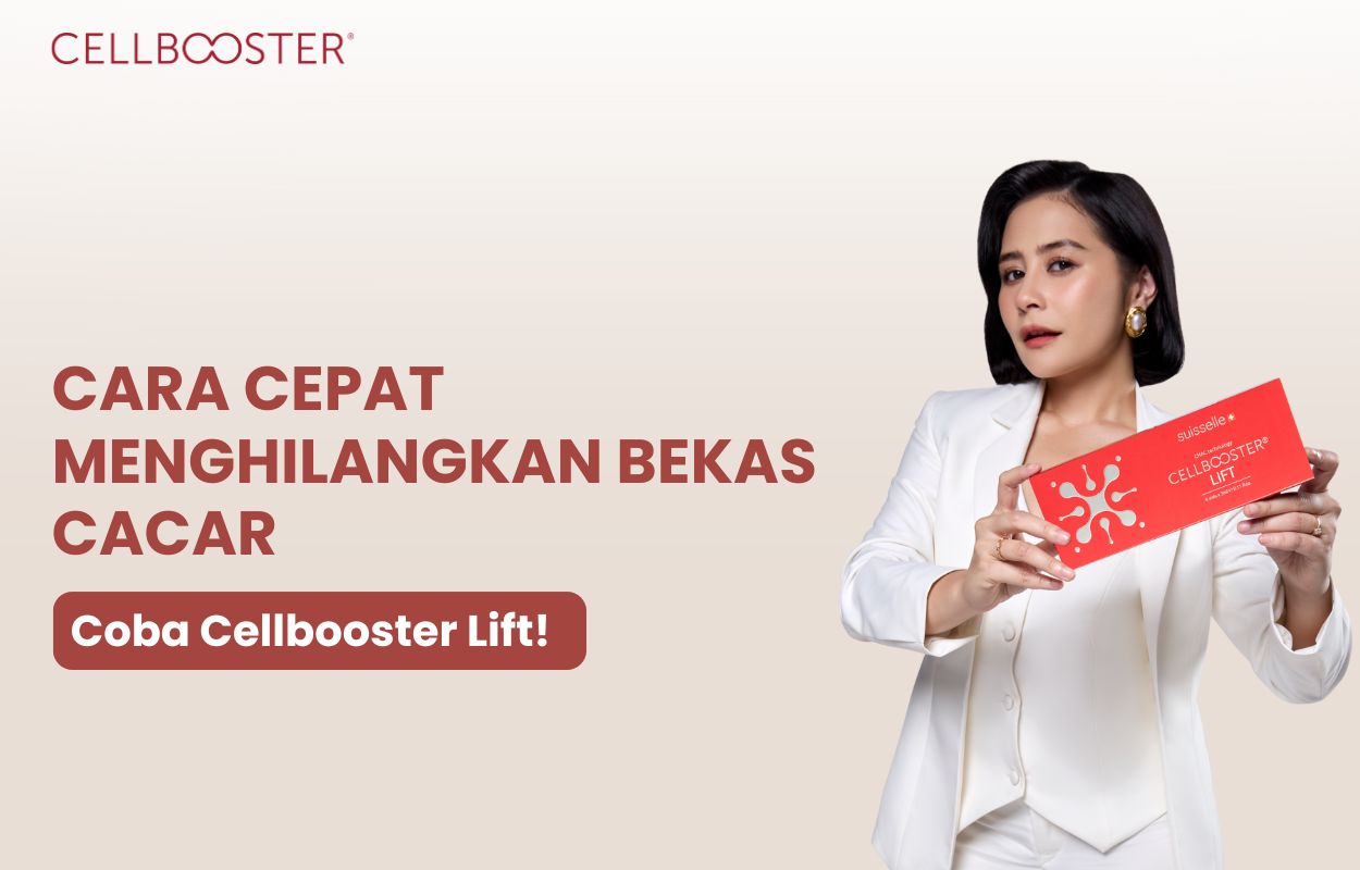 cara menghilangkan bekas cacar