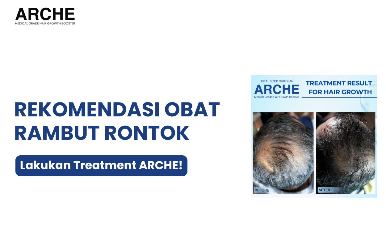 obat rambut rontok