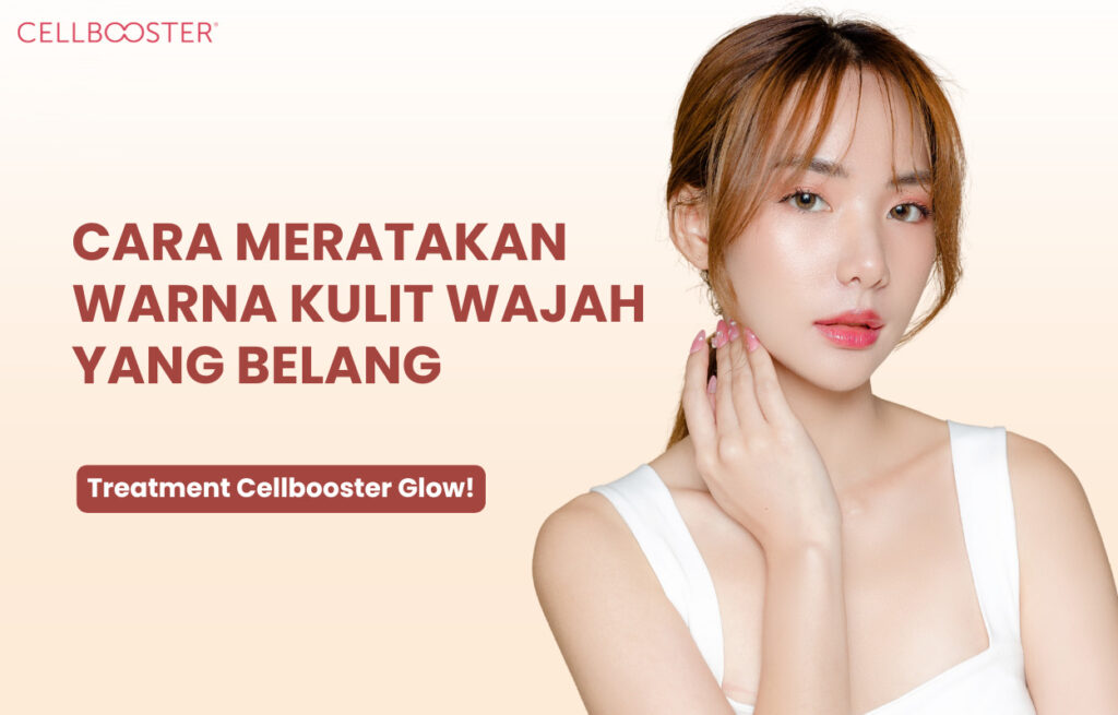 Cara Menghilangkan Belang di Muka