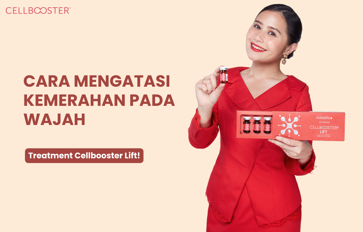 Cara Mengatasi Kemerahan pada Wajah